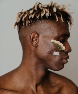 Face of a man with acne marks